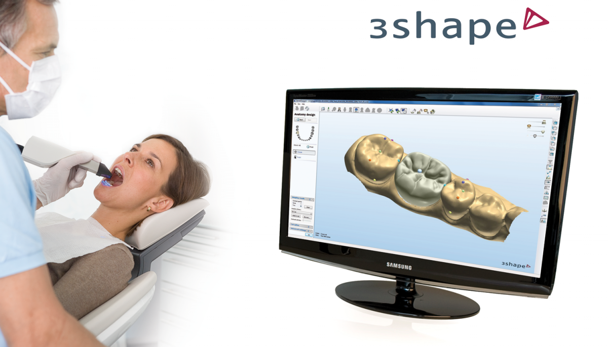 Image de 3shape-677e8051a482c.png