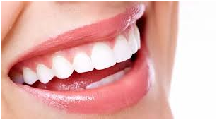 Image de Les facettes dentaires